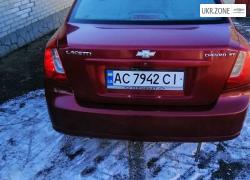 Седан Chevrolet Lacetti I 2005 в Локачах